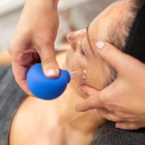 From above of hand applying cupping therapy with blue facial cup to woman with dark hair during skin treatment in beauty spa